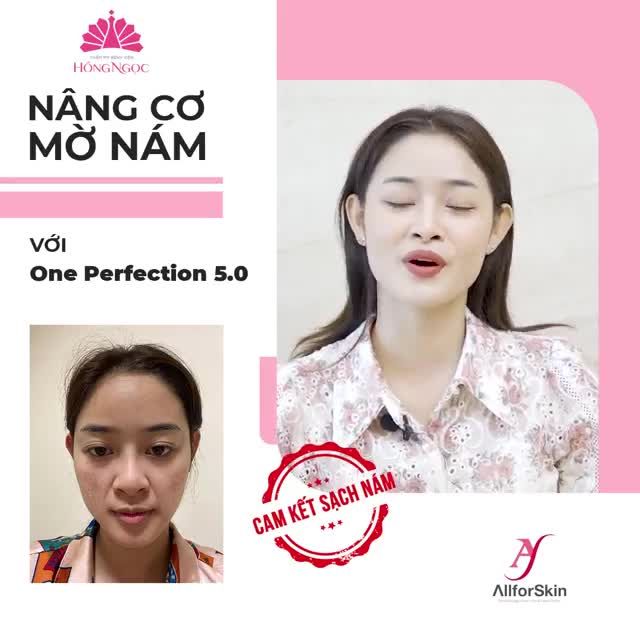 1 NGÀY THẤY MÌNH TRONG GƯƠNG ĐẦY NÁM VÀ NẾP NHĂN, LIỆU BẠN CÓ CÒN HẠNH PHÚC?