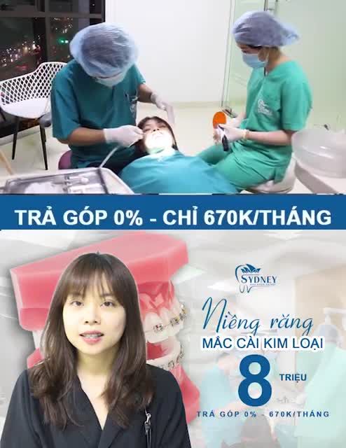 4 VẤN ĐỀ QUAN TRỌNG CẦN PHẢI LƯU Ý KHI NIỀNG RĂNG MẮC CÀI KIM LOẠI THƯỜNG