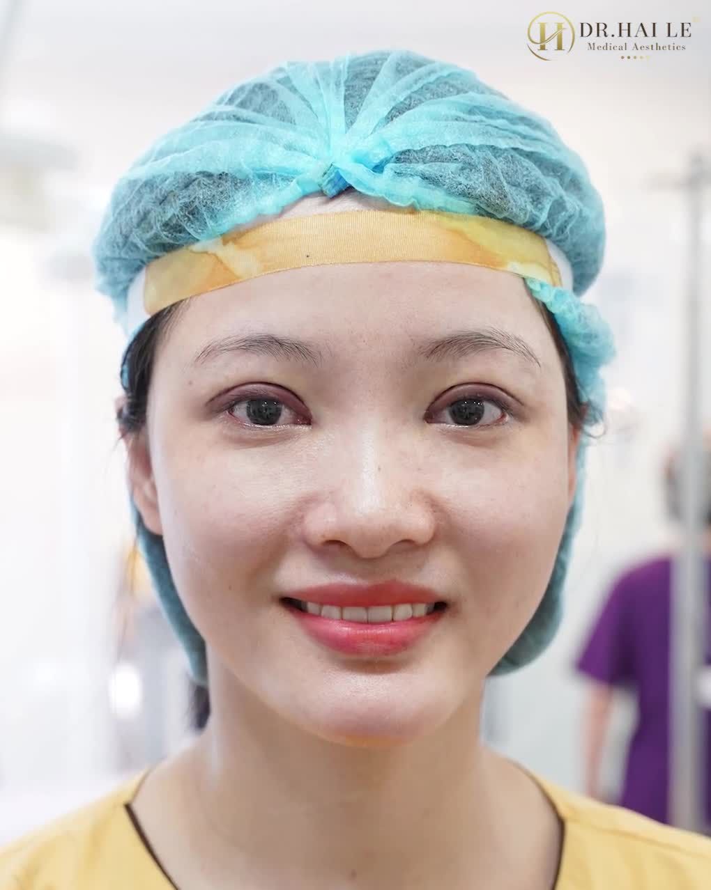 Ai cũng nói HỐI HẬN sau khi sửa mí HỐI HẬN vì không tới Dr.Hải Lê sửa sớm hơn