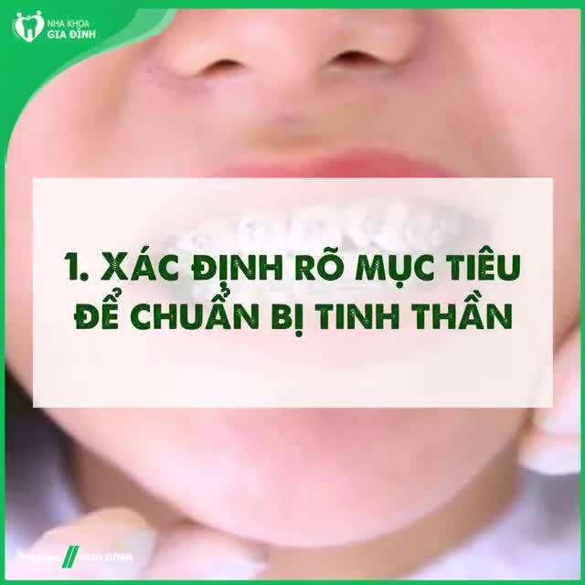 Ai đang có ý định niềng răng thì đừng bỏ qua 4 điều cần biết dưới đây!
