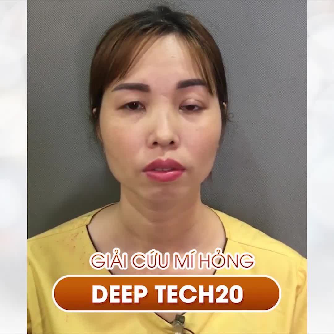 Bác sĩ Hải Lê không chắc chắn và cũng không dám khẳng định 10 ca sửa mí tại Dr.Hải Lê sẽ có kết quả hoàn hảo tuyệt đối cả 10