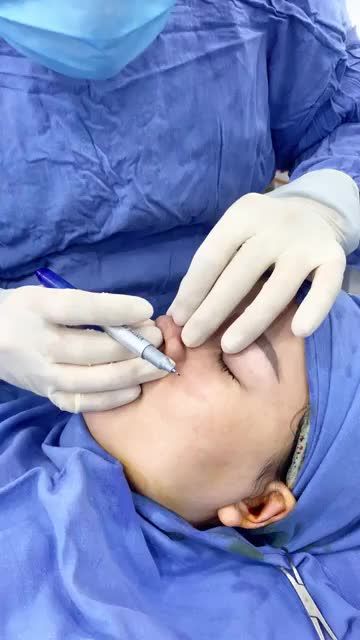 Bác sĩ phân tích nâng mũi Cấu trúc 4D Nano from tại BVTM KANGNAM