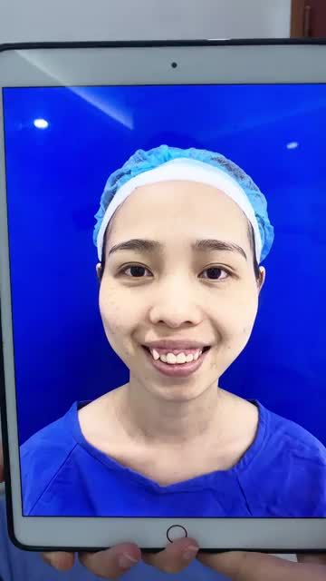 BẮT NGỜ với kết quả CHỈNH HÀM HÔ Sau 20 ngày