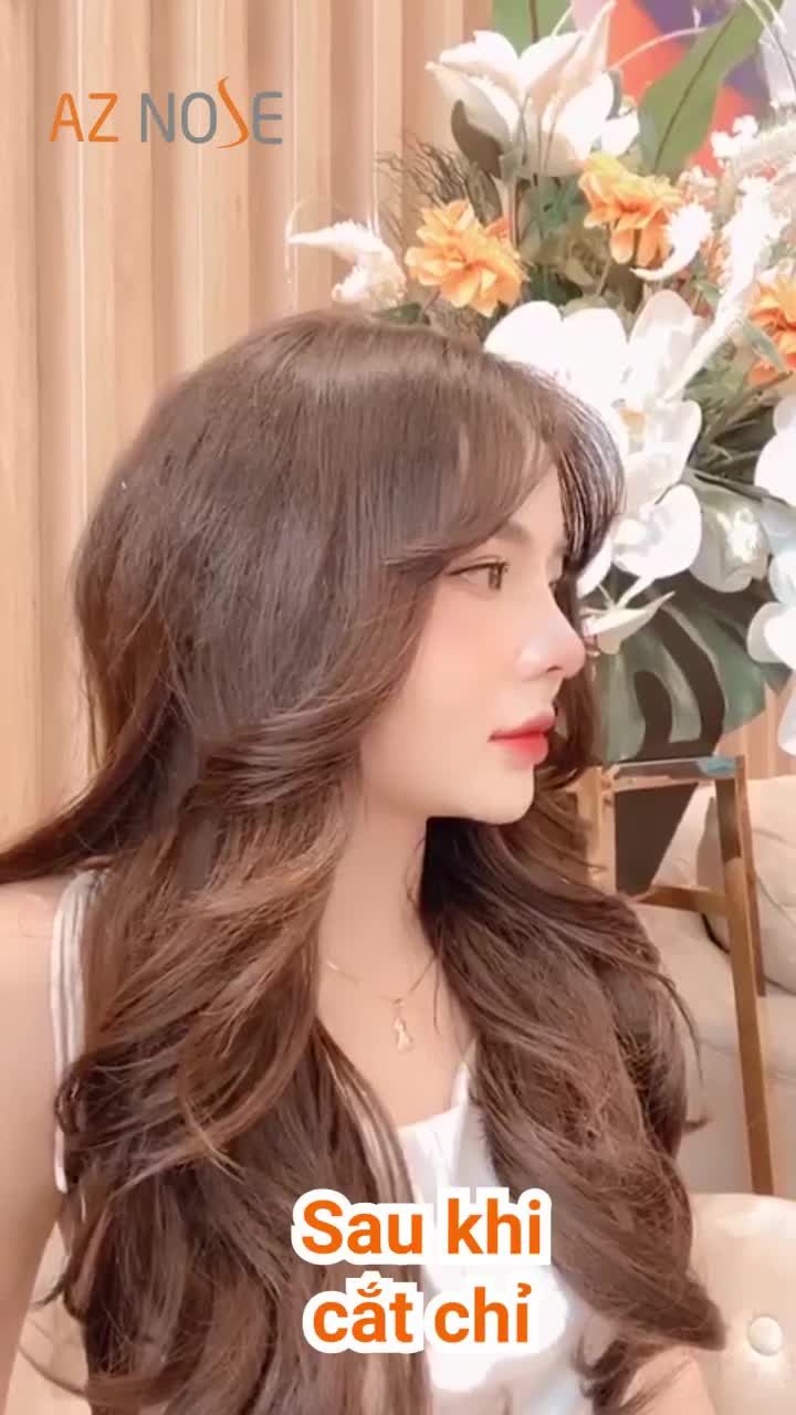Biến hình "sương sương" sau 15 ngày nâng mũi