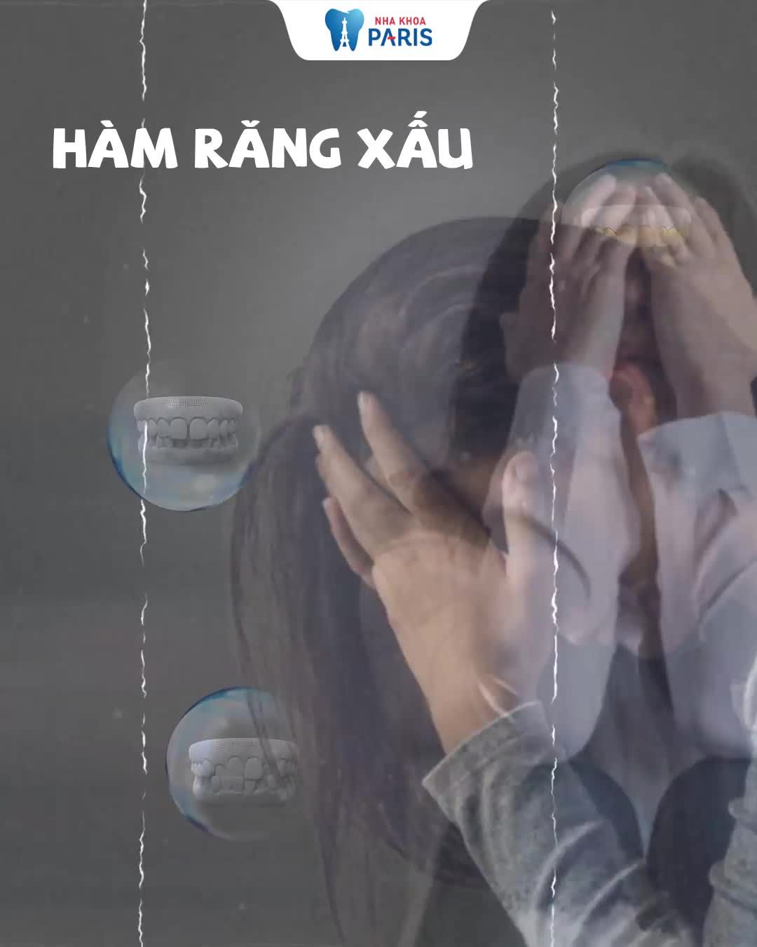 Bọc răng sứ cải thiện đến 99% tình trạng hô, thưa, khấp khểnh, nhiễm màu