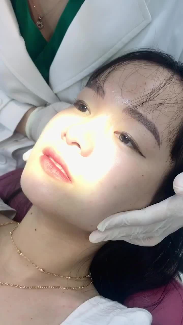 Botox thon gọn hàm - Filler mũi để thu hút hơn, tươi tắn trong mọi khung hình.