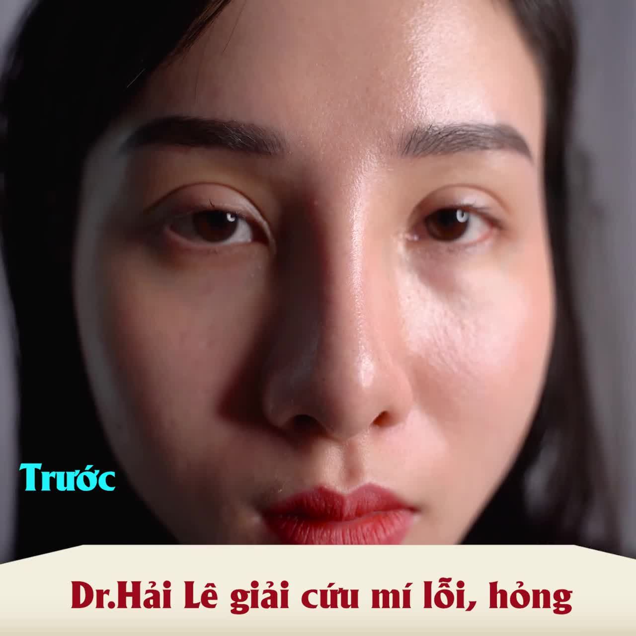 Ca mí sửa nhưng kết quả thì gọi là "cực phẩm" Đẹp mê mẩn thế này, đến con gái còn mê huống chi là đấng mày râu