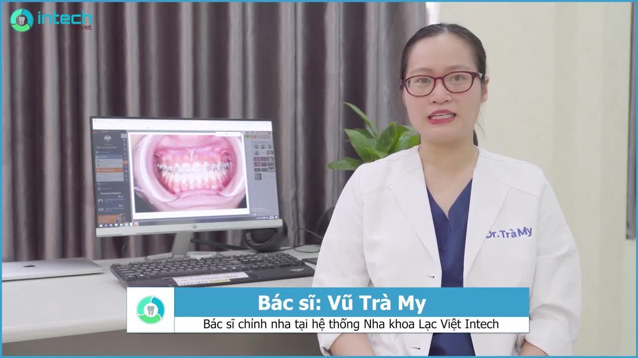 CA NIỀNG RĂNG MÓM THAY ĐỔI SAU 3 THÁNG ĐIỀU TRỊ - PHÂN TÍCH CÙNG CHUYÊN GIA