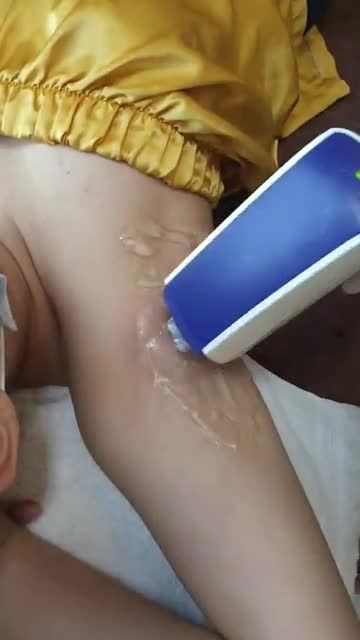 Cận cảnh quy trình triệt lông mặt với công nghệ Diode Laser tại Kangnam