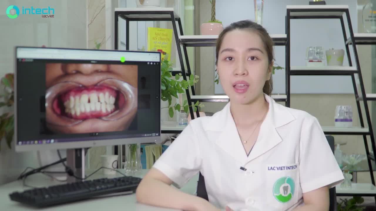 CASE THƯA, HÔ NẶNG THAY ĐỔI SAU 10 THÁNG ĐIỀU TRỊ
