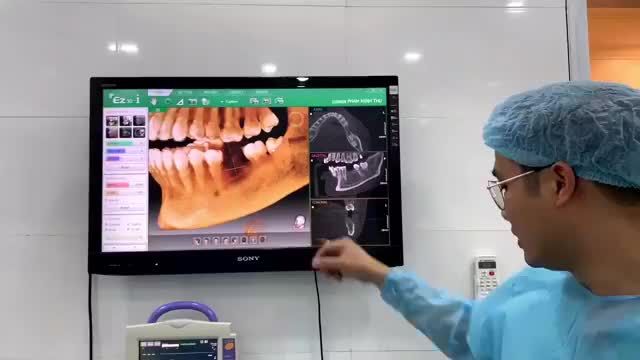 Cấy ghép Implant trong phòng vô khuẩn chỉ  1 phút tại Nha khoa Quốc tế Việt Pháp