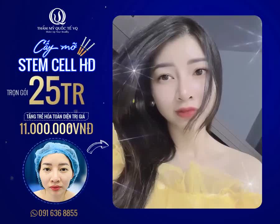 CẤY MỠ MẶT - TÁI TẠO 10 NĂM THANH XUÂN