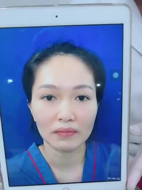 CẤY MỠ NANOFAT - LÀM ĐẦY HỐC HÁC - TRẺ HÓA TOÀN DIỆN