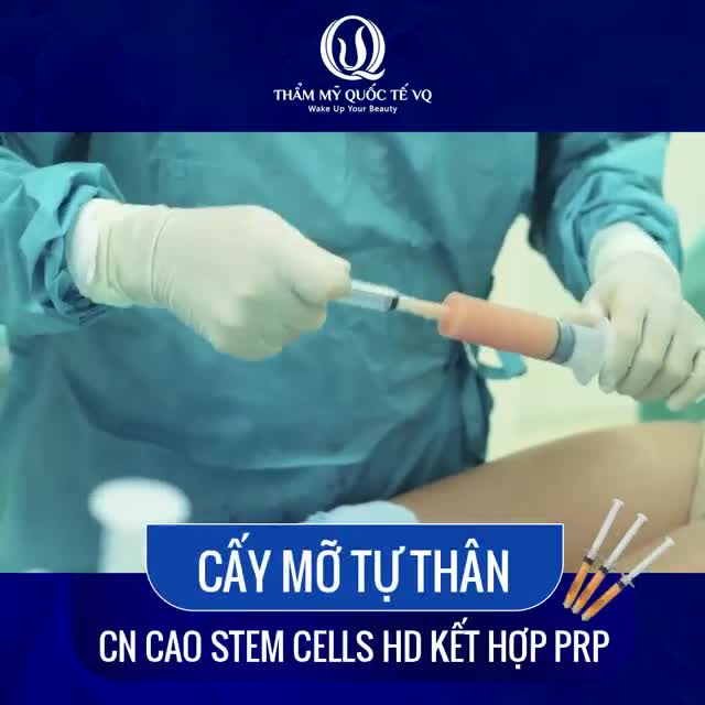 CẤY MỠ TỰ THÂN - "PHÉP MÀU" TRẺ HÓA CHO CHỊ EM GẦY, HỐC HÁC