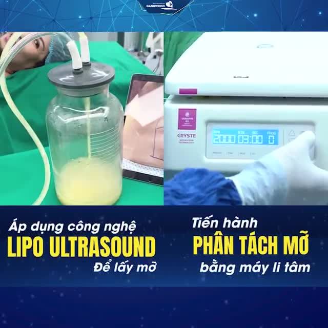 CẤY MỠ TỰ THÂN - TRẺ HOÁ GƯƠNG MẶT