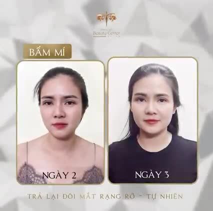 CHỈ 30 PHÚT VĨNH BIỆT NGAY ĐÔI MẮT LỜ ĐỜ THIẾU SỨC SỐNG!