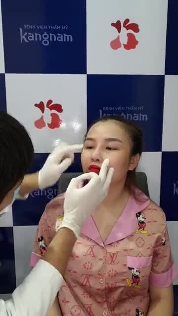 Chỉ NÂNG CAO SỐNG MŨI không thì lại DỄ QUÁ