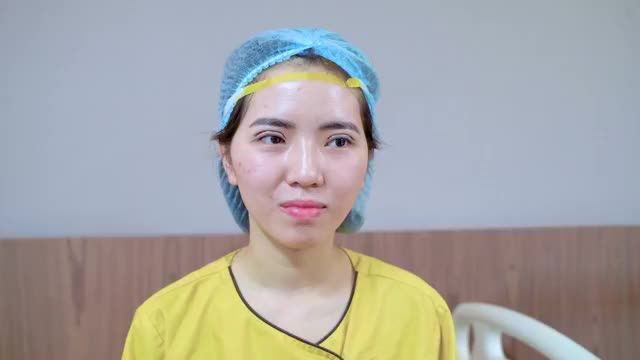 Chỉ sau 45 phút Cắt mí khách hàng đã sở hữu cho mình một đôi mắt rạng rỡ trẻ xinh Mời quý khách hàng cùng đón xem