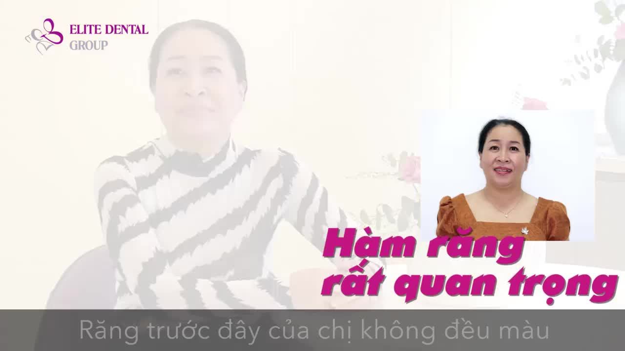 “Chị thường xuyên tham dự sự kiện nên hàm răng quan trọng lắm. Làm răng xong, chị cười đẹp và tự tin hơn hẳn”