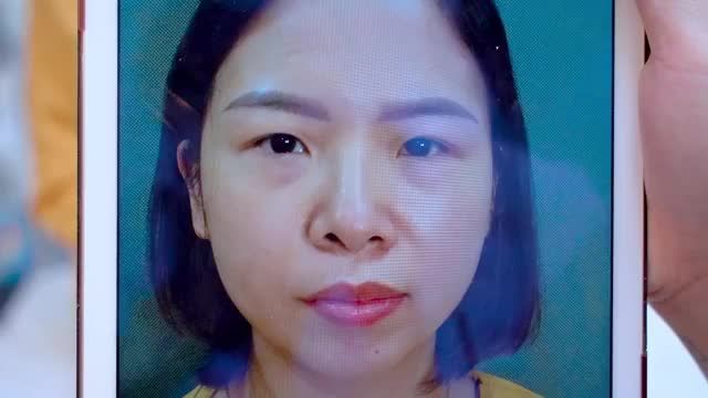 Chiêm ngưỡng người thật việc thật combo trẻ hóa đôi mắt Nâng cung mày + Cắt mí tại Dr.Hải Lê để có thêm động lực làm đẹp bạn nhé