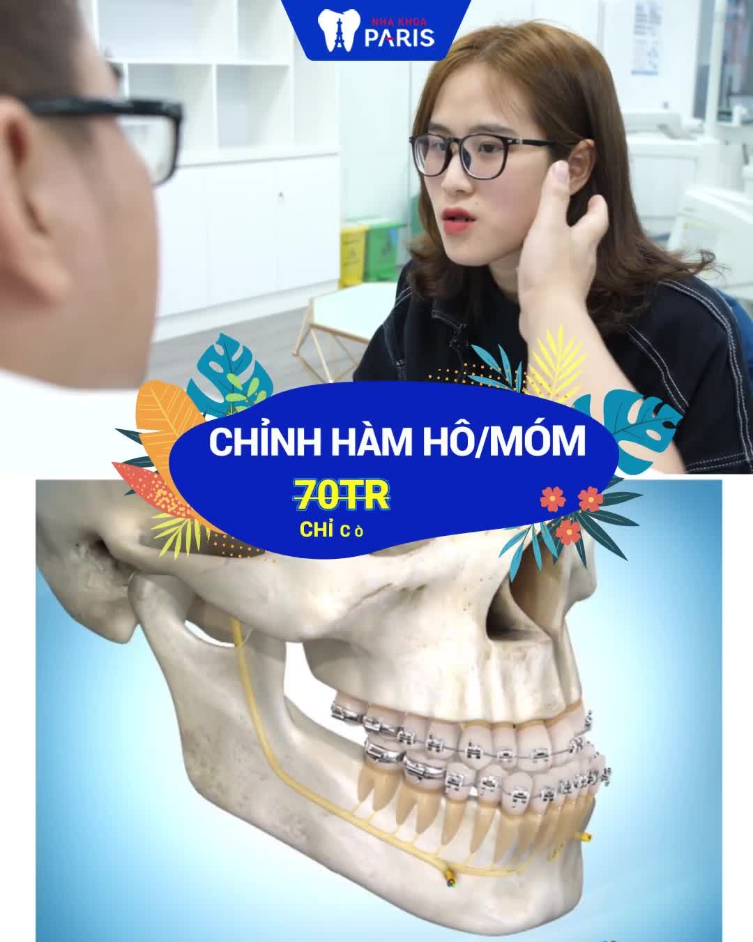 CHỈNH HÌNH HÀM MẶT - SALE HÈ OFF 30%