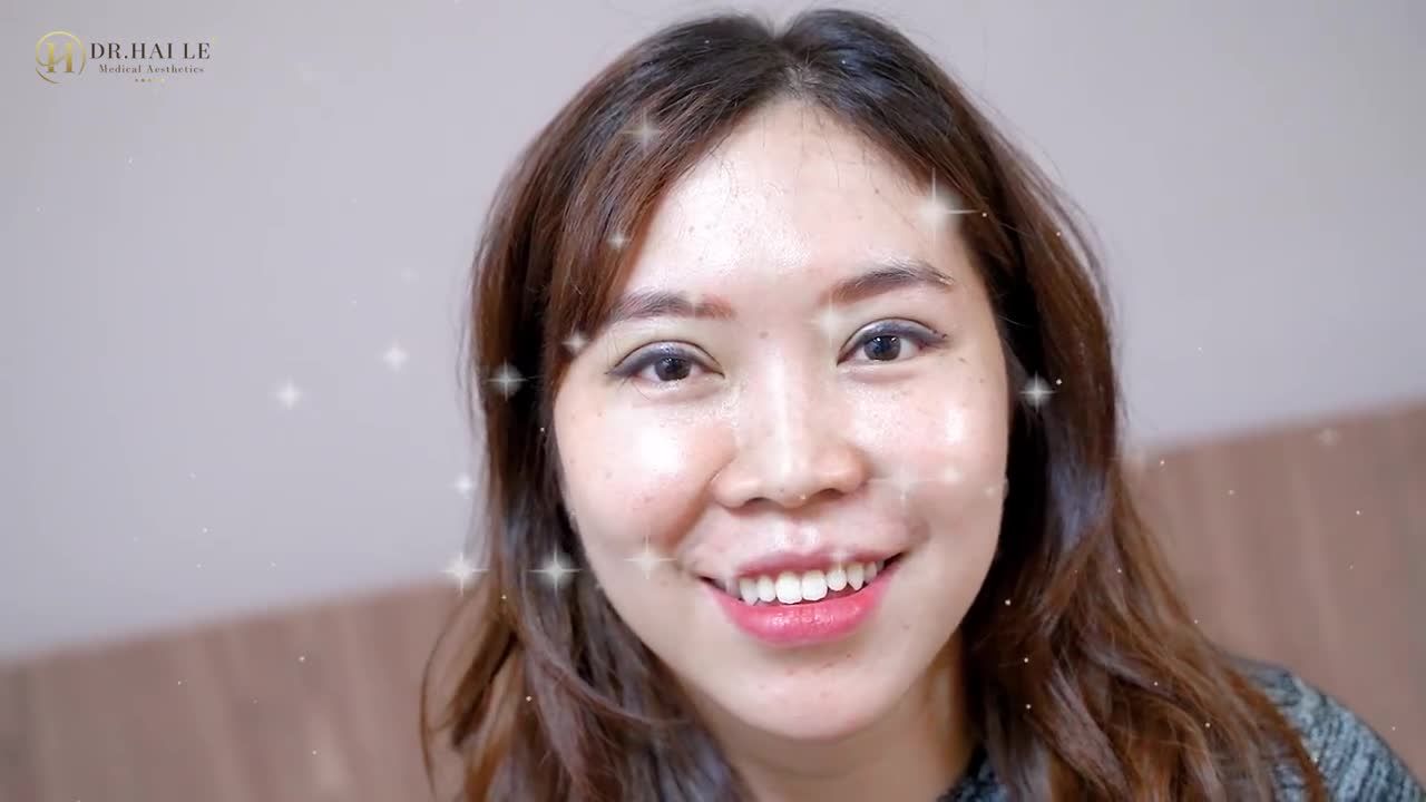 Có một sự thật là cứ 10 khách hàng sửa mí tại Dr.Hải Lê thì có tới 9 người tấm tắc khen và 1 người thì gật đầu hài lòng.