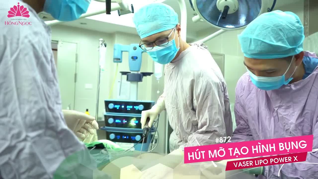 COMBO HÚT MỠ TẠO HÌNH BIẾN "BỤNG THÙNG PHI" HÓA BODY HOÀN HẢO