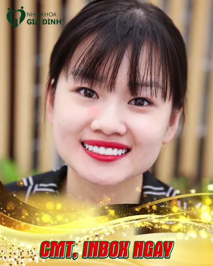 CỰC PHẨM RĂNG ĐẸP NÀY SẼ KHIẾN BẠN ĐẾN NHA KHOA GIA ĐÌNH NGAY LẬP TỨC