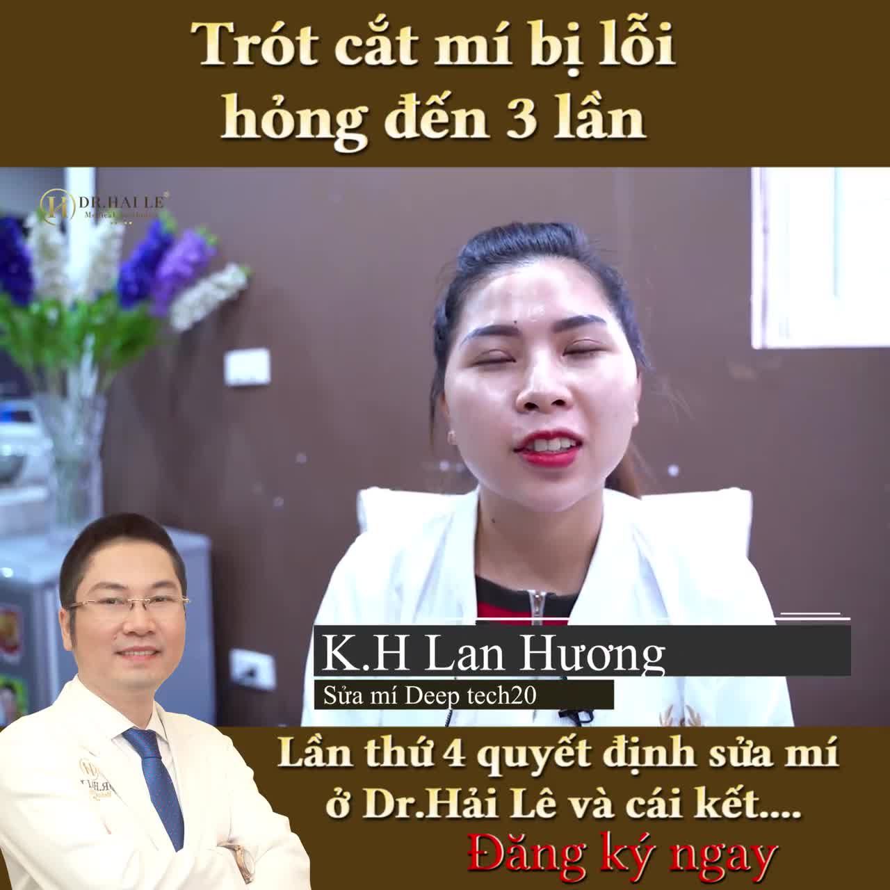 Cùng nghe tâm sự của cô gái 3 lần làm mí hỏng và phải đến lần thứ 4 khi cô tìm đúng Bác sĩ, chữa đúng bệnh, đúng kỹ thuật Kết quả đã thành công ngoài sự mong đợi!