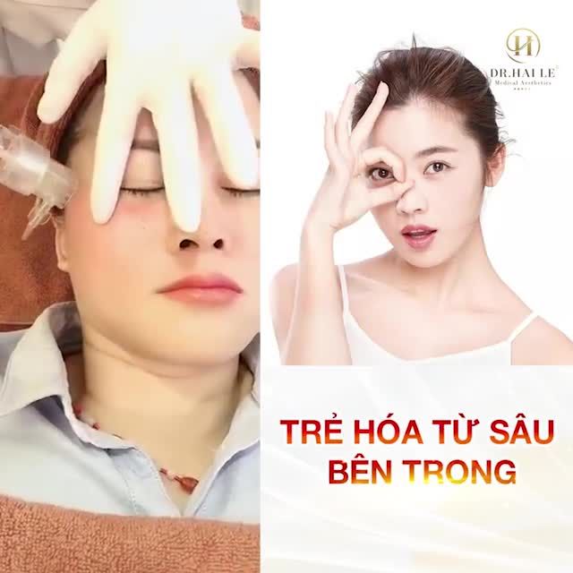 Da trắng sáng đẹp rạng rỡ ngày hè với CN cấy tinh chất trắng sáng trẻ hỏa da!