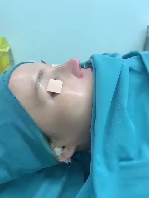 Dáng mũi Latin mềm mại cho bạn gái