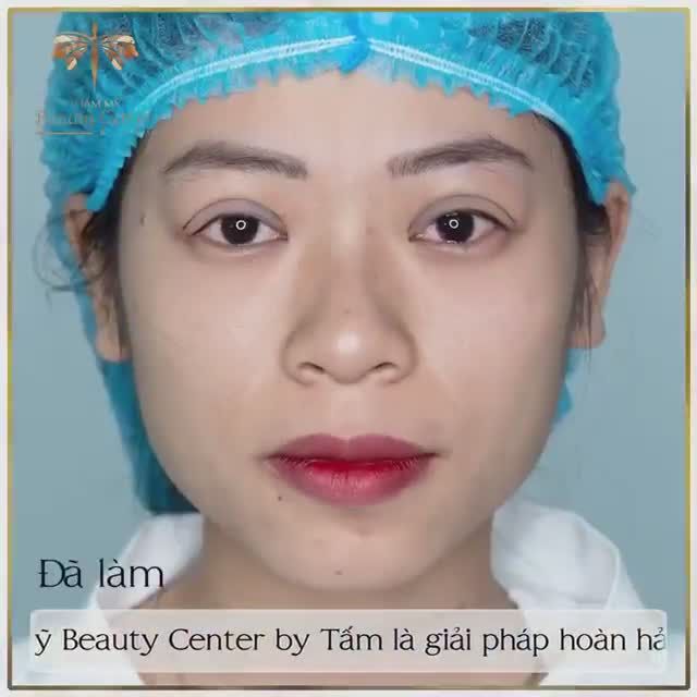 ĐẸP NHƯ CHƯA TỪNG CHỈNH SỬA !