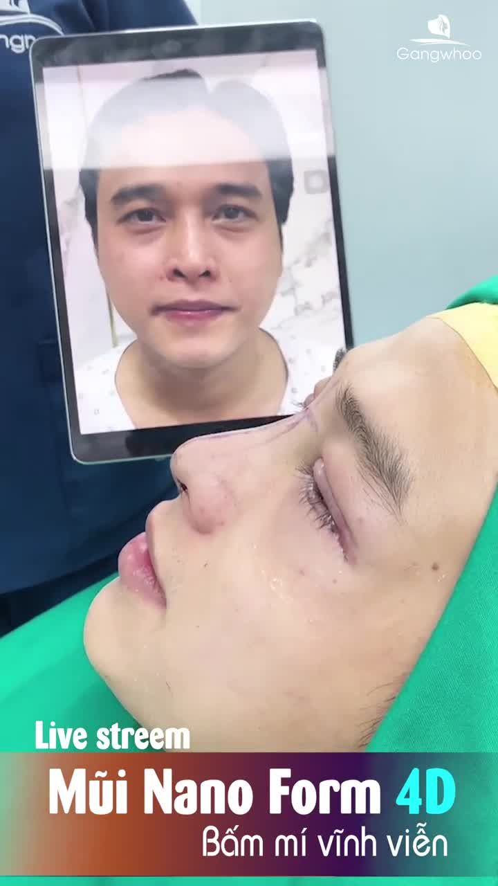 DIỄN VIÊN THÁI ĐÌNH DƯƠNG CHỌN DR.PARK LÀ NƠI TỐT NHẤT ĐỂ LÀM ĐẸP