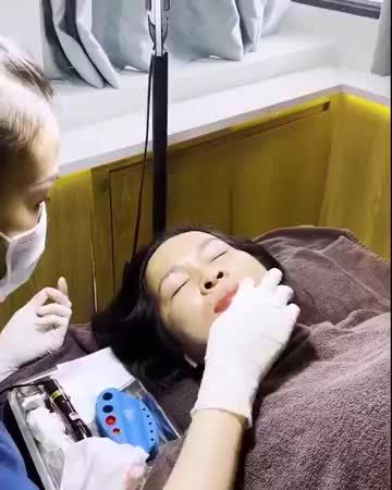 ĐỈNH CAO CÔNG NGHỆ XÓA MỜ MÔI THÂM Cận cảnh KHỬ THÂM, PHUN MÔI