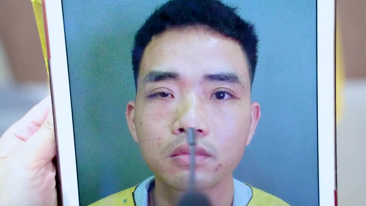 DR.HẢI LÊ GIẢI CỨU MỌI CA MÍ LỖI HỎNG TRẢ LẠI CHO BẠN ĐÔI MẮT LÀNH LẶN, ĐẸP THẨM MỸ!