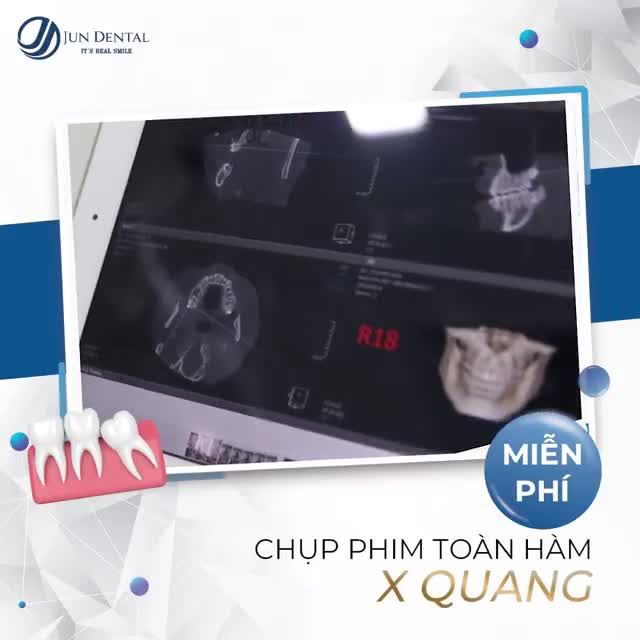 ĐỪNG ĐỂ RĂNG KHỔN TRỞ THÀNH NỖI ÁM ẢNH SUỐT MÙA HÈ CỦA BẠN