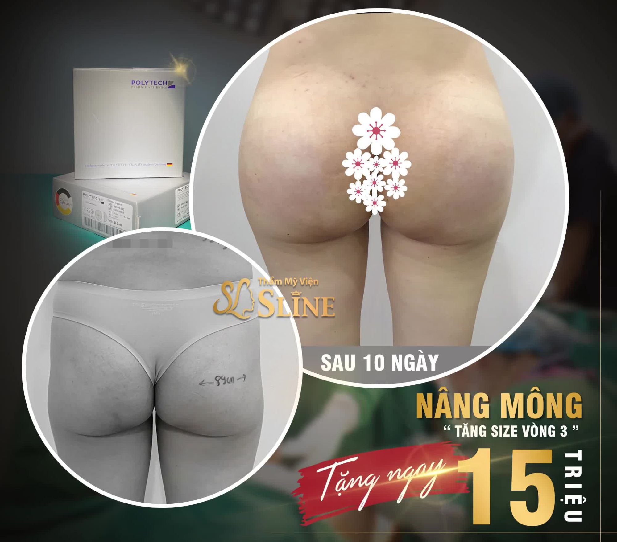 FEEDBACK V3 ĐẸP HOÀN HẢO
