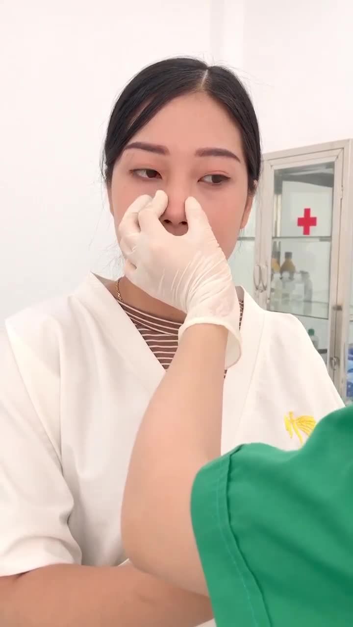 Filler mũi cho khách hàng tại chi nhánh Đà Nẵng