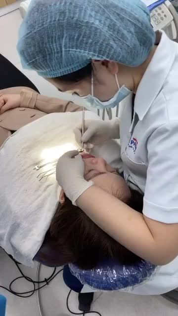 Gắn Mắc Cài Kim Loại Thường Tại Nha Khoa Paris Kim Mã cho chị Đặng Thu Huyền do Bác sĩ Phan Thị Hồng Tiến thực hiện