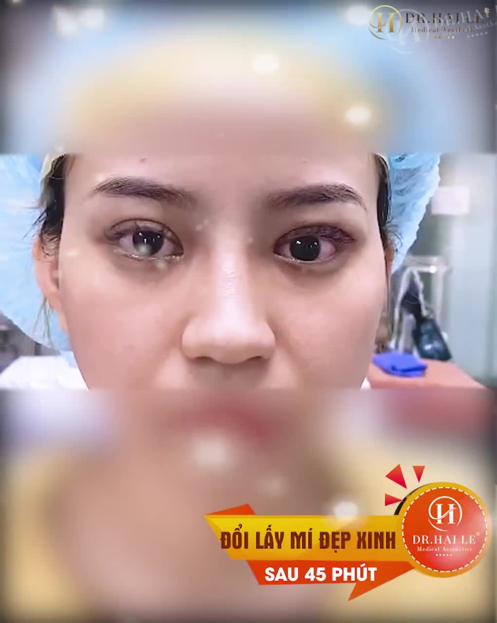 GIẢI CỨU MỌI CA MÍ HỎNG TỪ NẶNG ĐẾN NHẸ TẠI CƠ SỞ DR.HẢI LÊ HCM