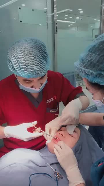 Giải pháp mới cho MÔI DÀY / LỆCH  Thu mỏng môi trái tim