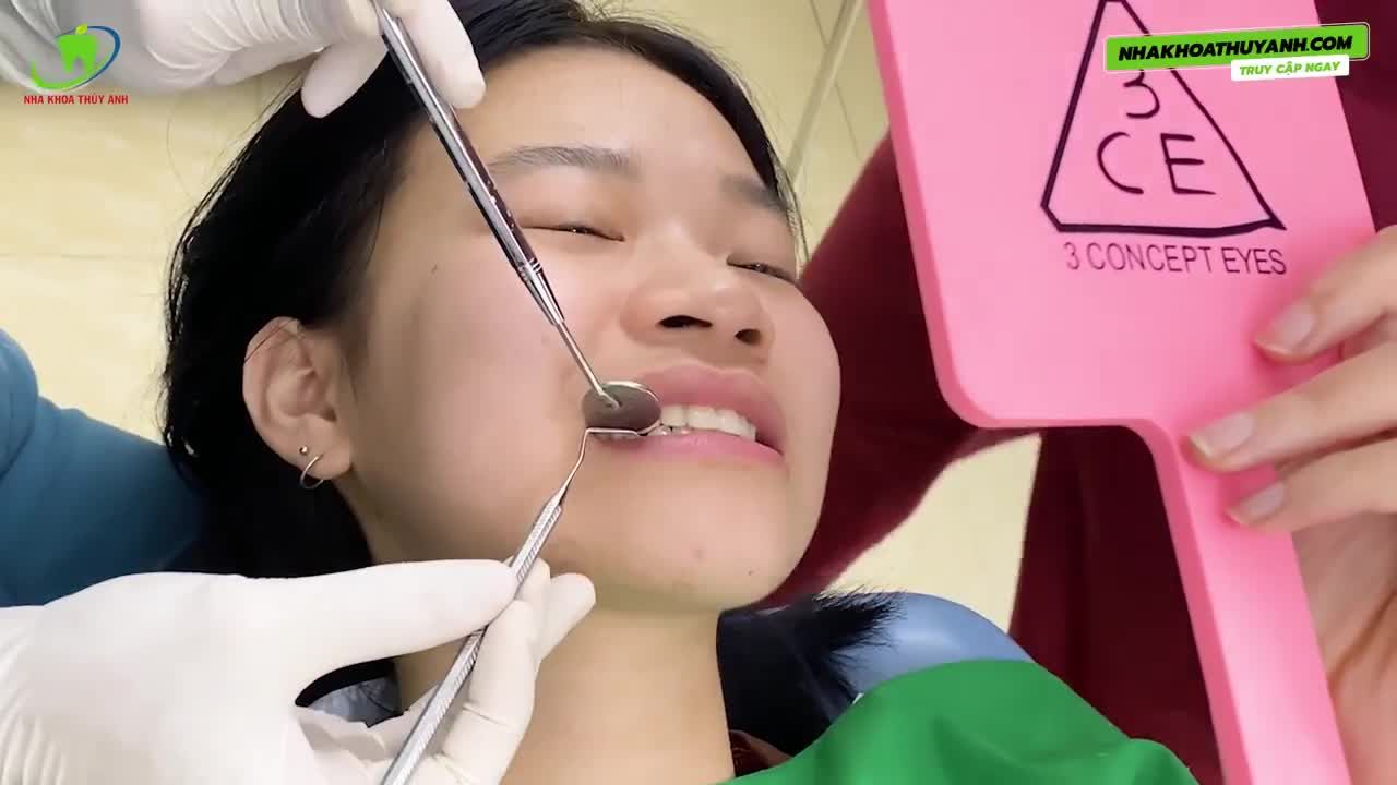 GIẢI PHÁP NÀO CHO NGƯỜI TRẺ BỊ MẤT RĂNG?