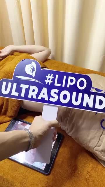 GIẢM MỠ TRIỆT ĐỂ - EO THON BẤT NGỜ SAU 1 THÁNG THỰC HIỆN LIPO ULTRASOUND