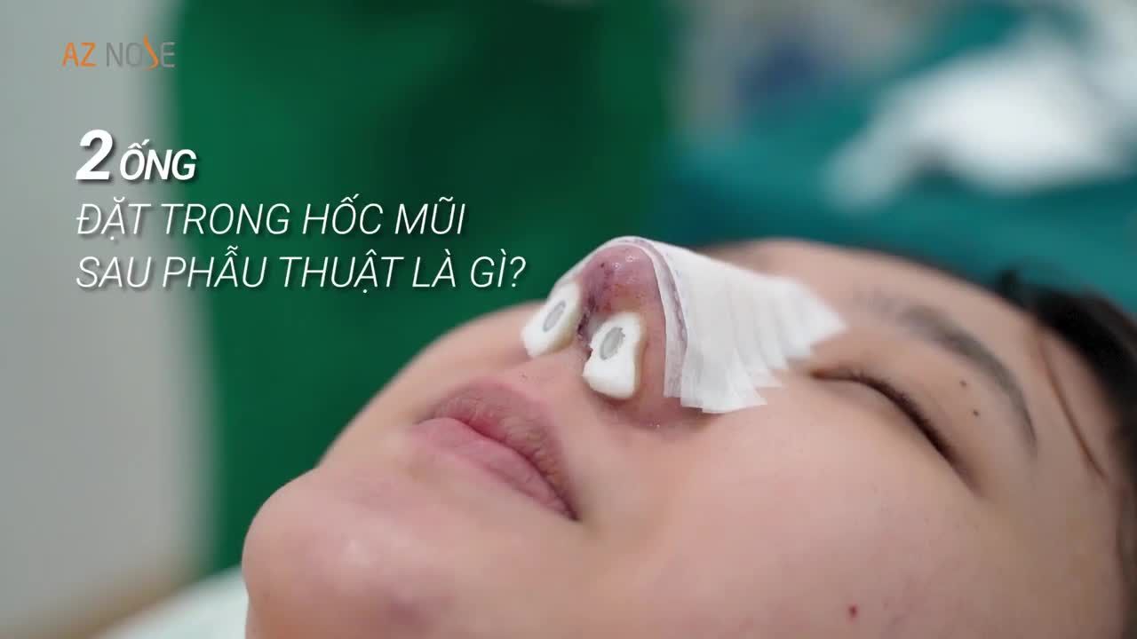 HAI ỐNG ĐẶT TRONG MŨI SAU PHẪU THUẬT Ở AZ NOSE LÀ GÌ?