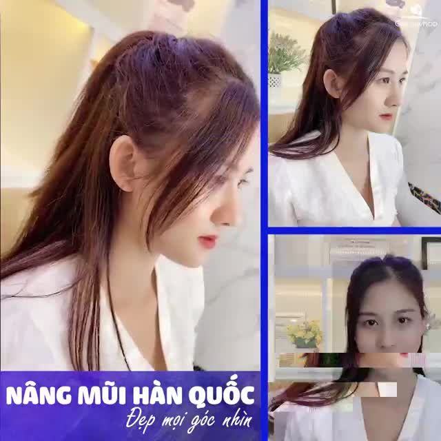 Hình ảnh bạn khách đáng yêu bên mình đi “tân trang” mũi đó ạ, nhìn chiếc mũi là muốn ngất ngây luôn thẳng gì mà thẳng quá vậy, đẹp gì mà đẹp không góc chết vậy