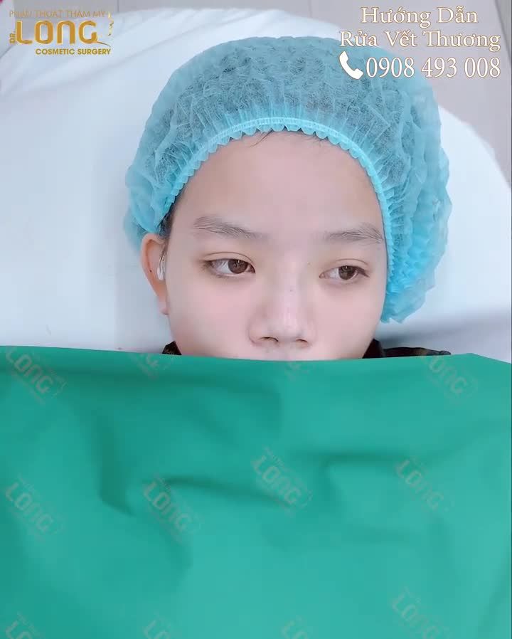 HƯỚNG DẪN CÁCH RỬA VẾT THƯƠNG SAU NÂNG MŨI TẠI NHÀ