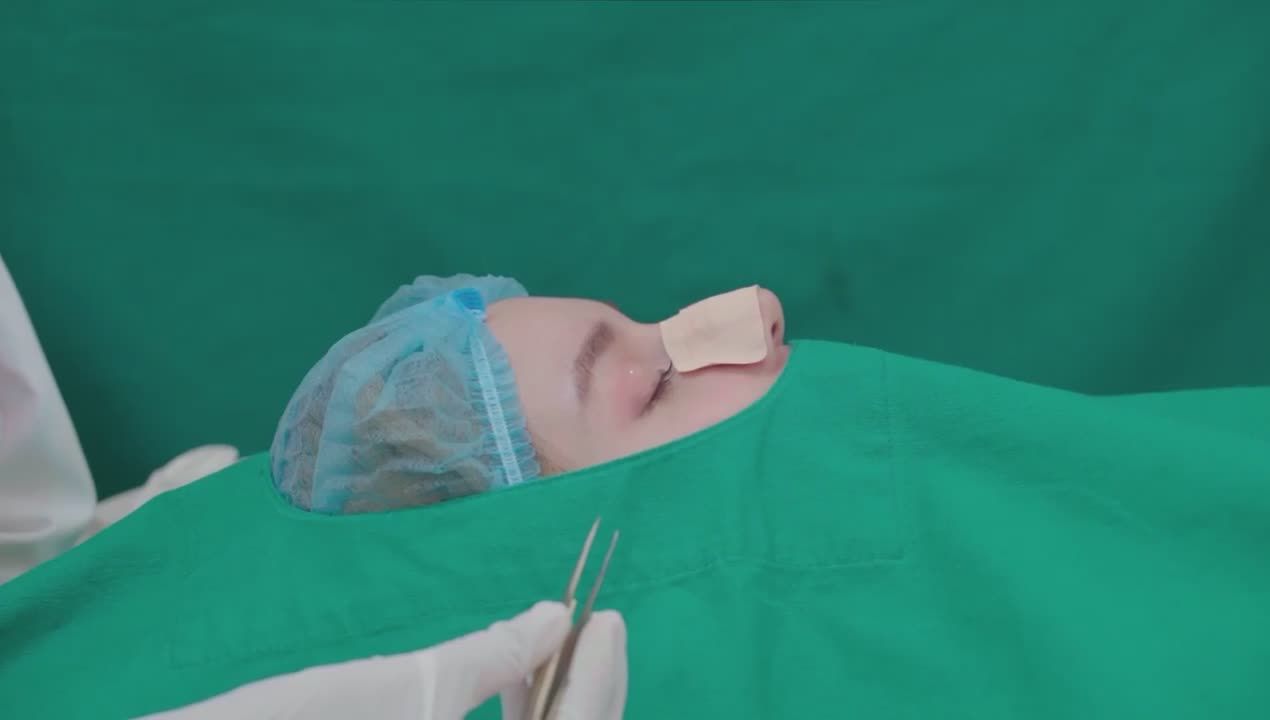 Kết quả của ca nâng mũi Surgiform xuất sắc tại Thẩm mỹ Beauty Center by Tấm.