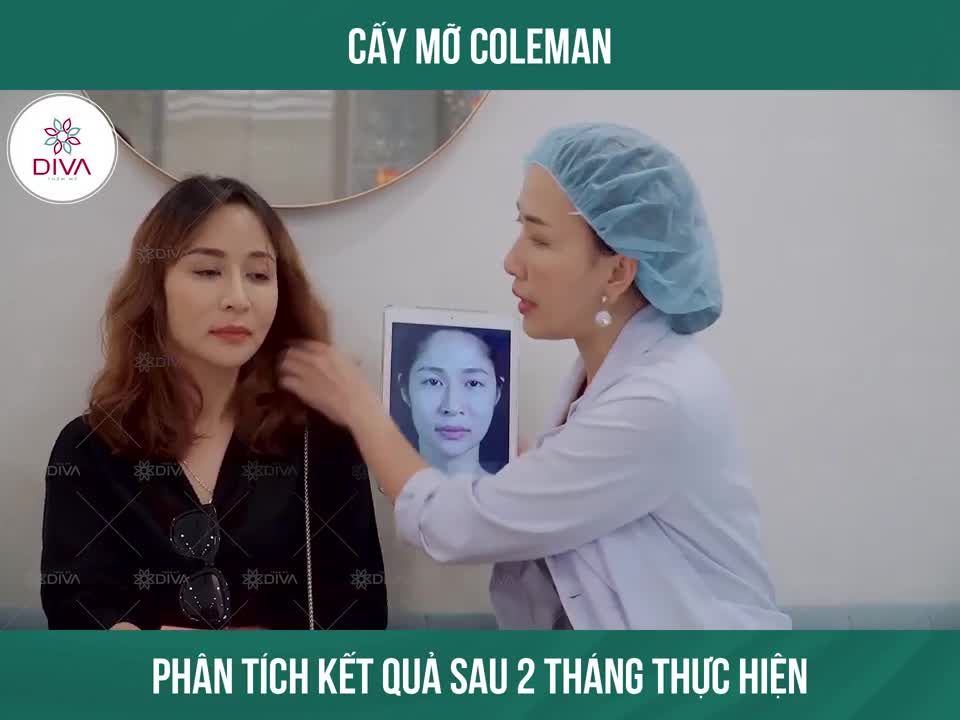 KẾT QUẢ SAU CẤY MỠ COLEMAN: GƯƠNG MẶT TRẺ TRUNG, THẦN THÁI RẠNG NGỜI XINH ĐẸP