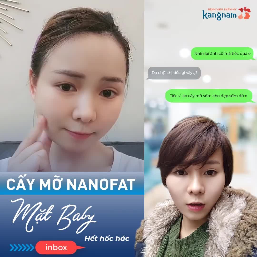 KH cấy mỡ sau 1 tháng gửi feedback cưng xỉu