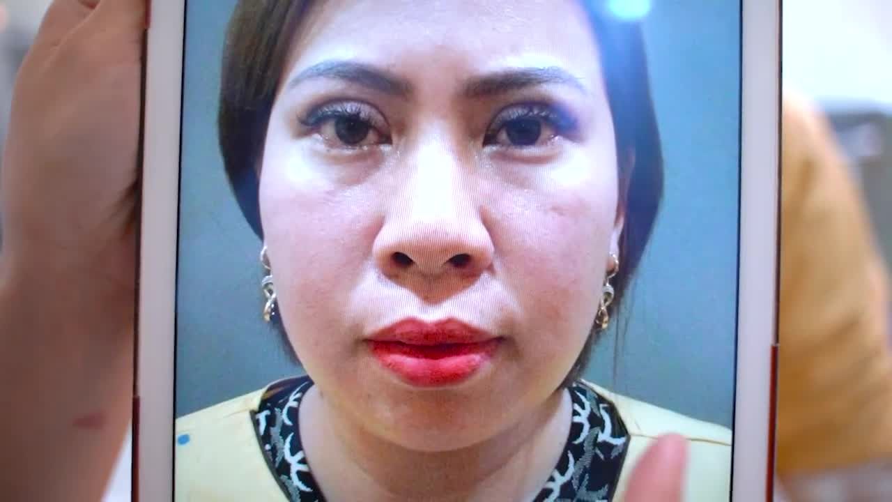 KH N.T chia sẻ: "Tôi sửa cái mí này xong, xem kết quả tôi nhẹ cả người..."
